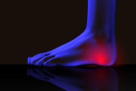 close-up x-ray image of foot red pain